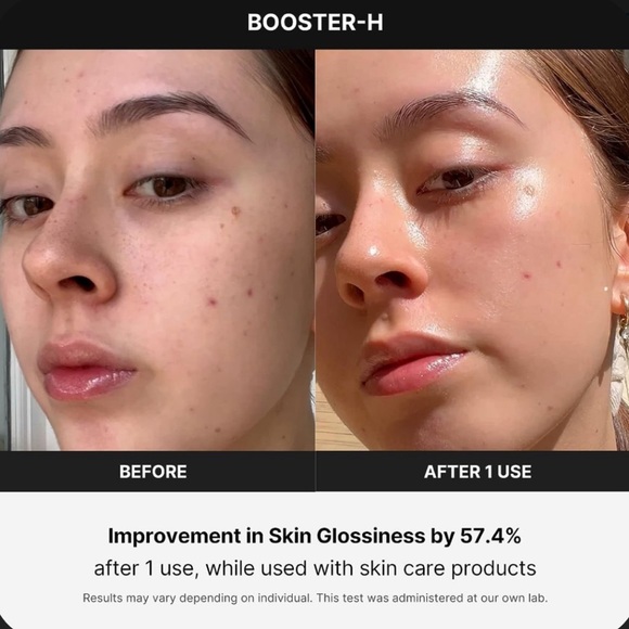 Medicube devices Special bundle!! - Picture 12 of 13